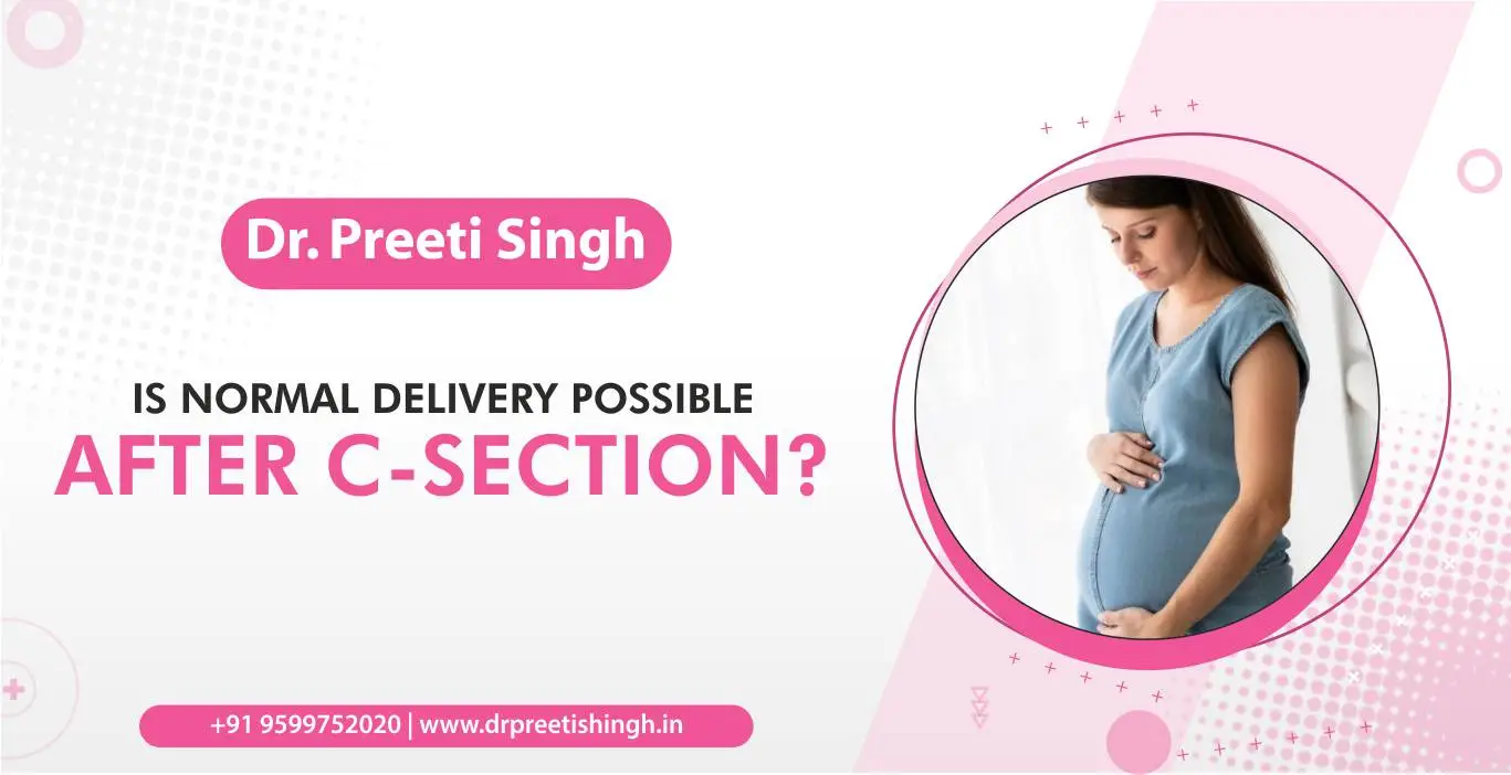 Is Normal Delivery Possible After C-section
